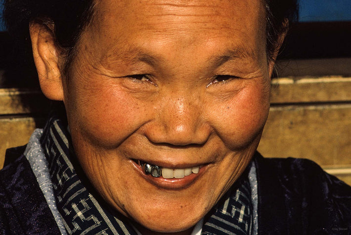 Close-up of Smiling Woman, Three Silver Teeth, Tokyo
