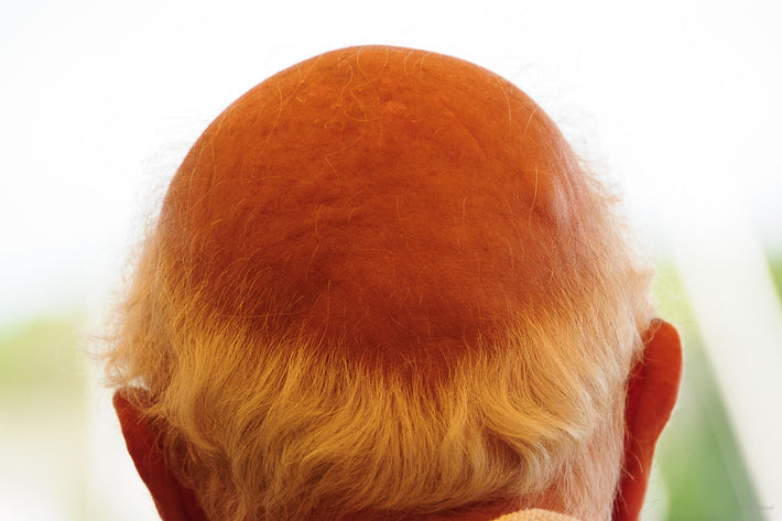 Back of Man's Head, Maine