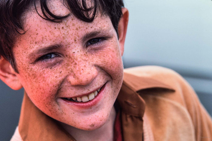 Boy with Freckles, Smiling, Ireland